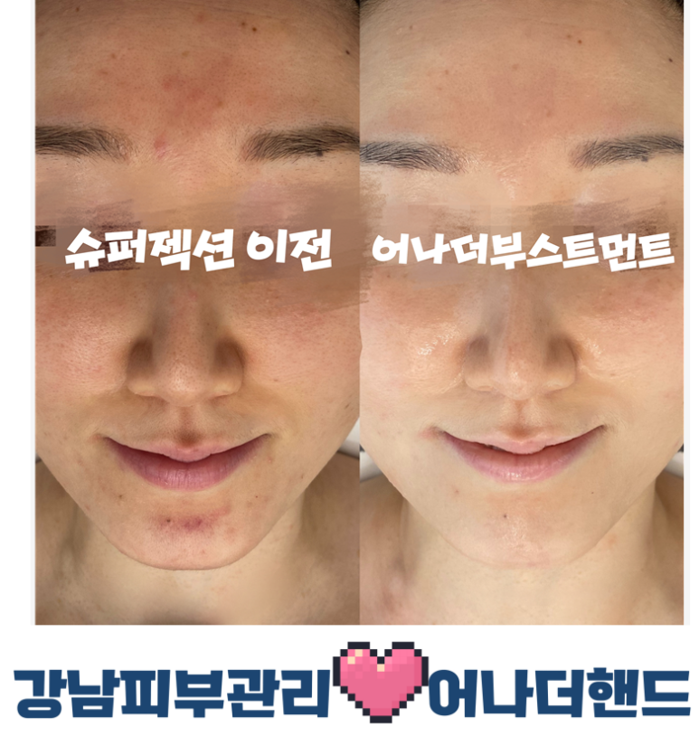어나더 핸드 이미지