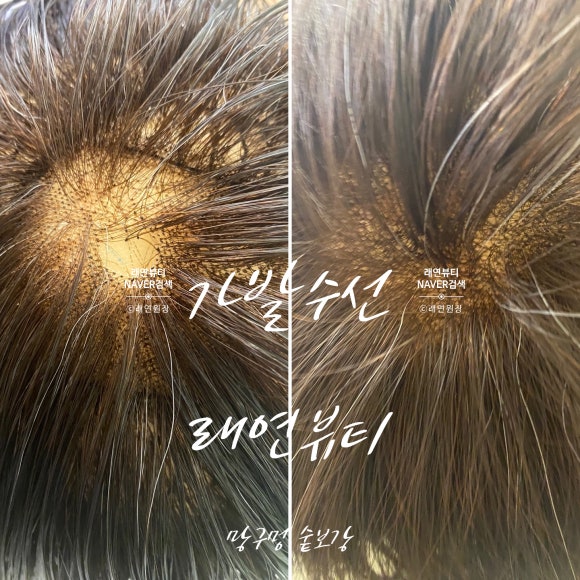 래연모이든 증모가발 토성점 이미지