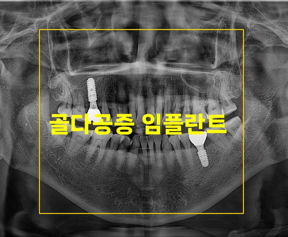 플란부평 이미지