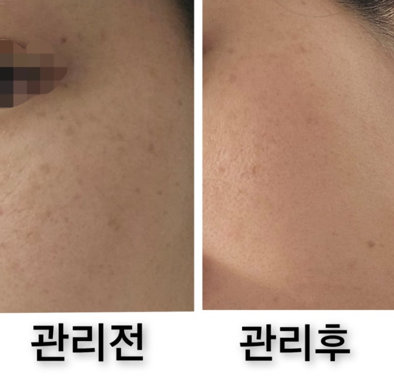 오늘은밝은피부 이미지