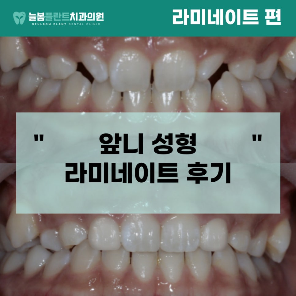 늘봄플란트치과 이미지