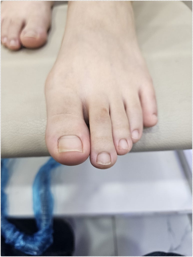 까망네일 이미지