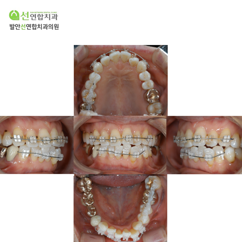 발안선연합치과 이미지
