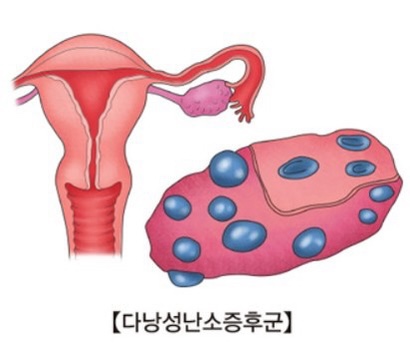 피트니스롬 이미지