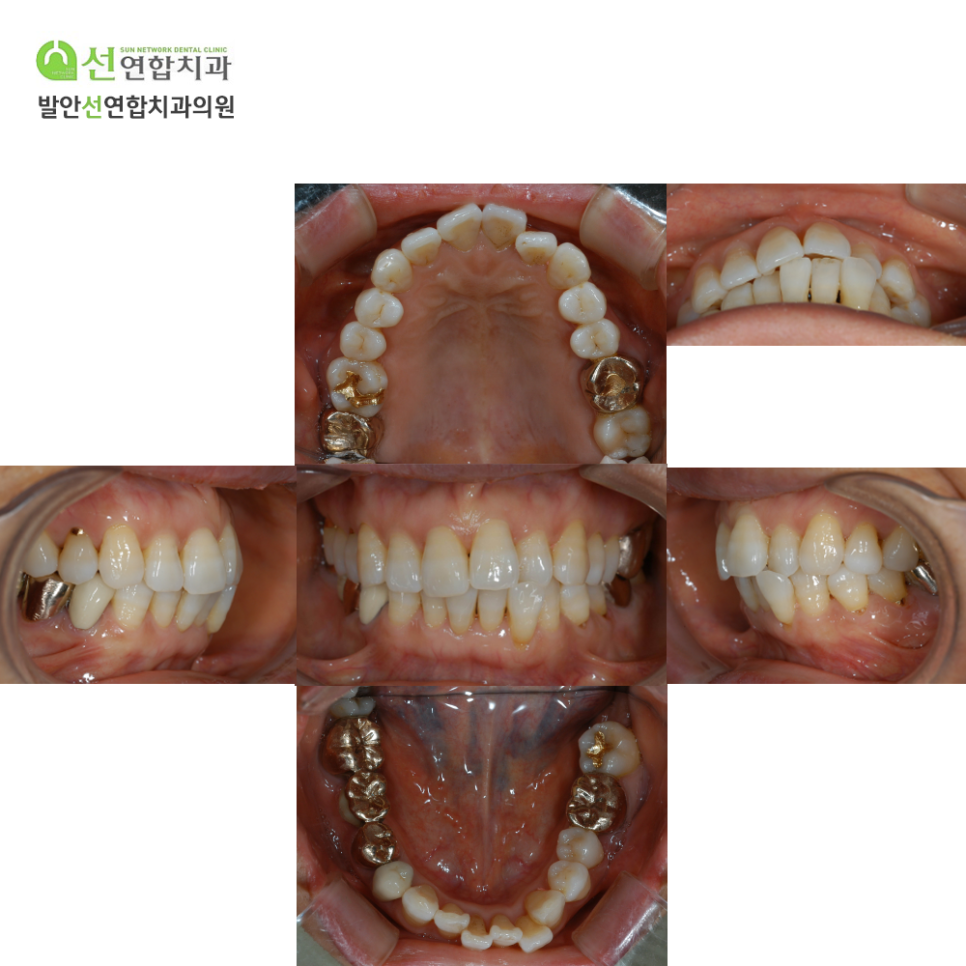 발안선연합치과 이미지