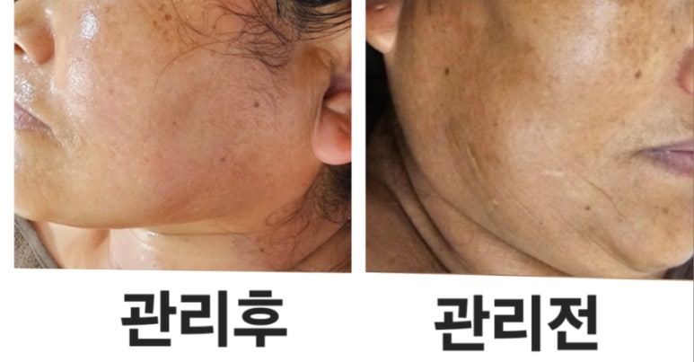 오늘은밝은피부 이미지