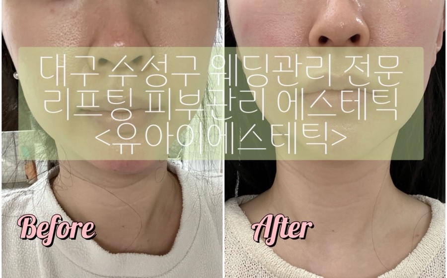 유아이에스테틱 이미지
