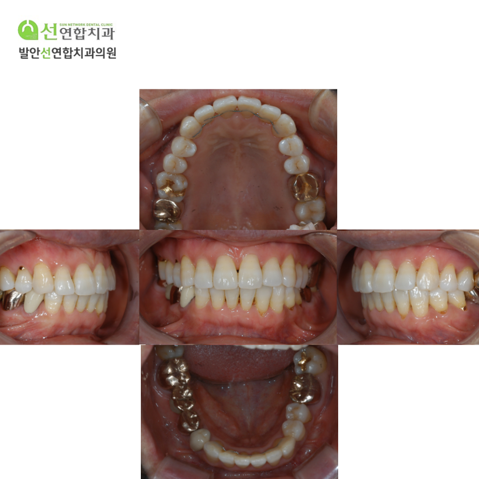발안선연합치과 이미지