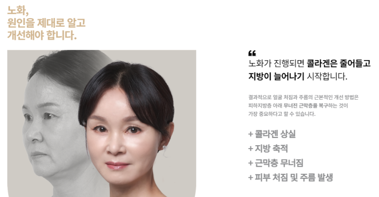 바노바기 성형외과 이미지