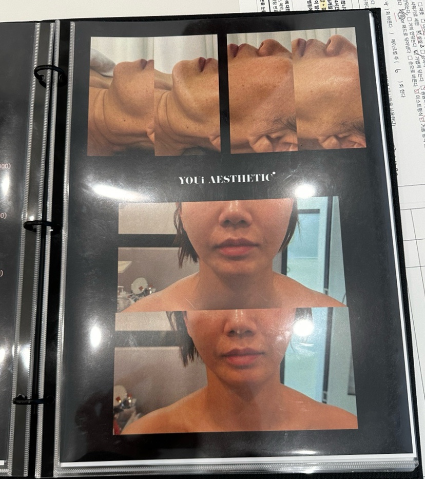 유아이에스테틱 이미지