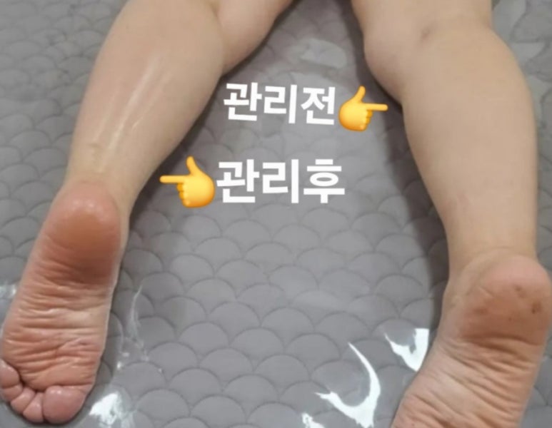오늘은밝은피부 이미지