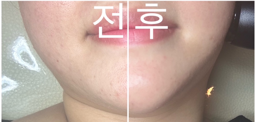 썬플라토 이미지