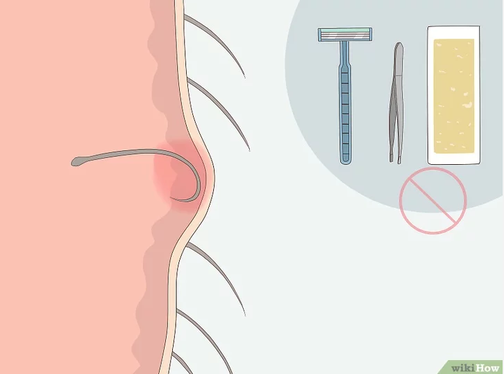 란헤어 이미지