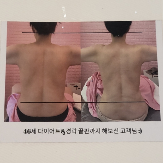 스킨바 수지성복점 이미지