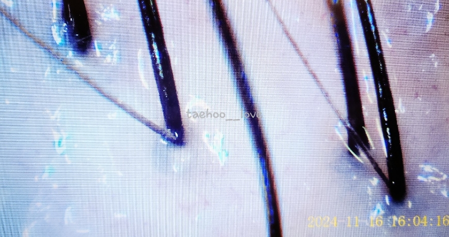 태후사랑 피부사랑 이미지