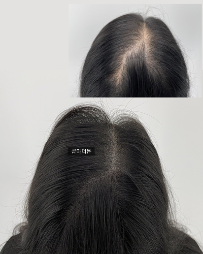 콤마더문 이미지