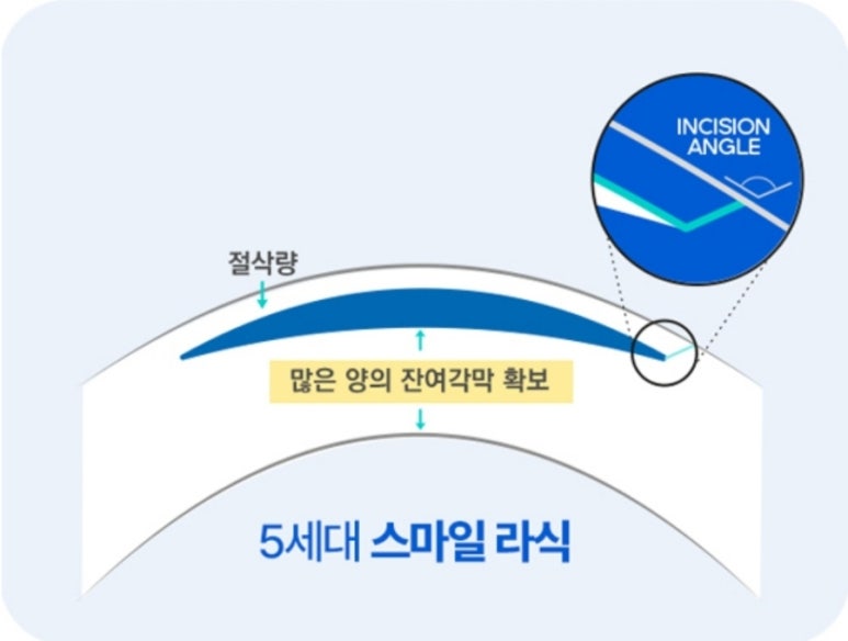 아이준안과 이미지
