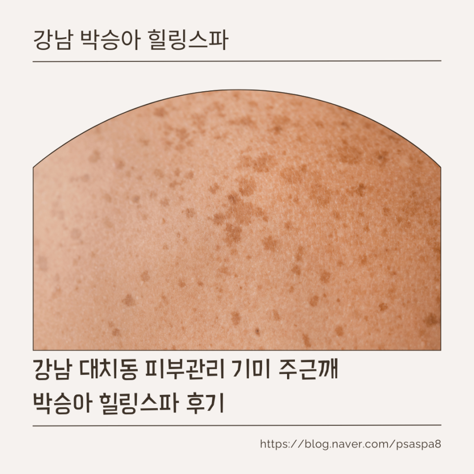 박승아 힐링스파 이미지