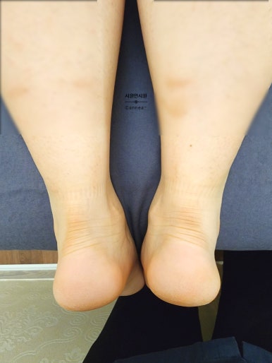 고아라스킨케어 이미지