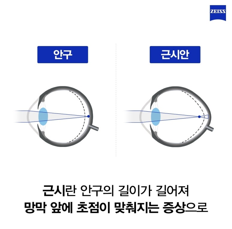 마이오 이미지