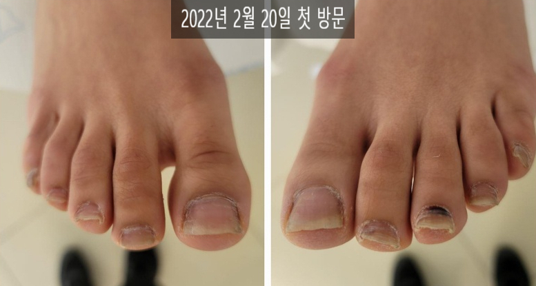 대전레푸스다솜네일 이미지