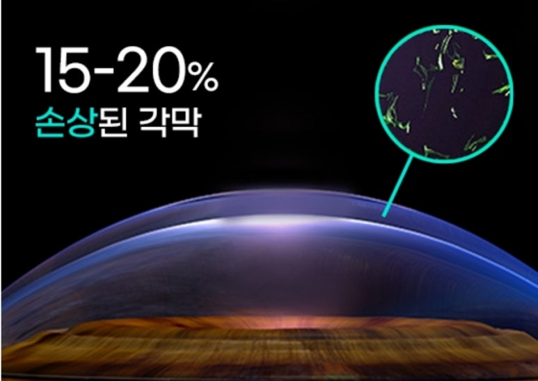 아이준안과 이미지