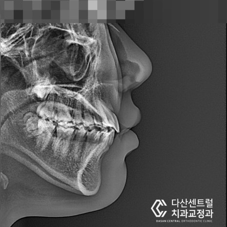 다산센트럴치과교정과치과의원 이미지