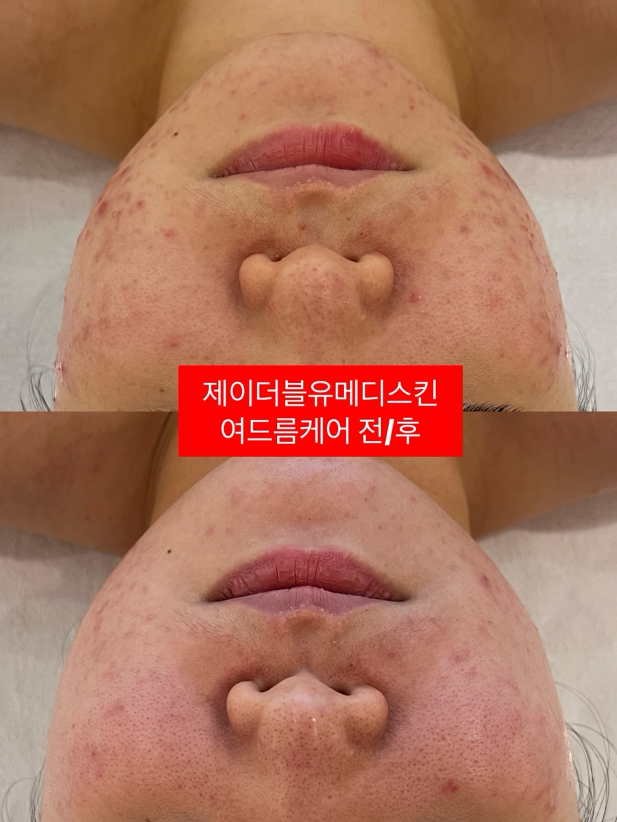제이더블유메디 이미지