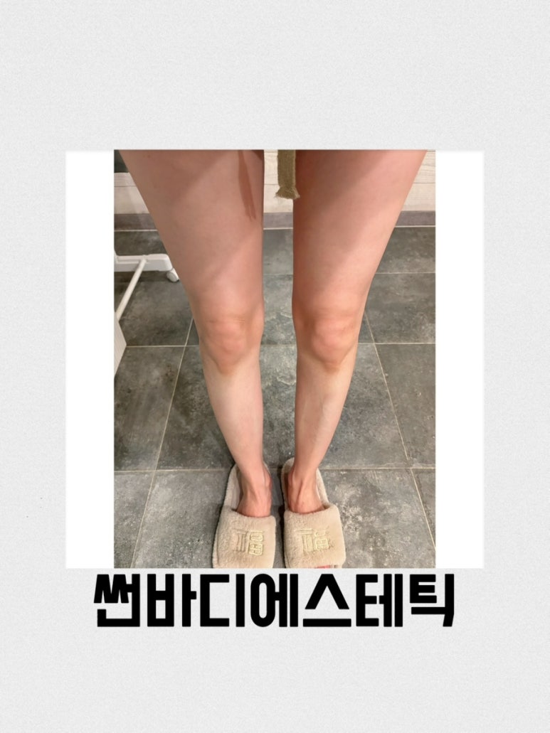 썬바디에스테틱 이미지