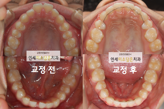 연세미소담은치과 이미지