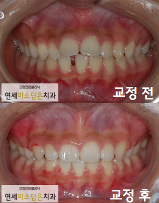 연세미소담은치과 이미지
