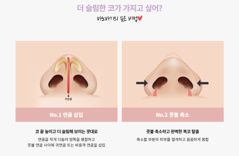 바노바기 성형외과 이미지
