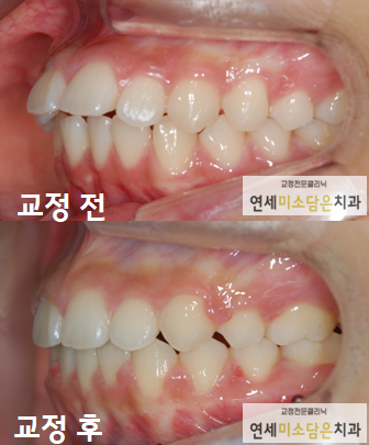 연세미소담은치과 이미지