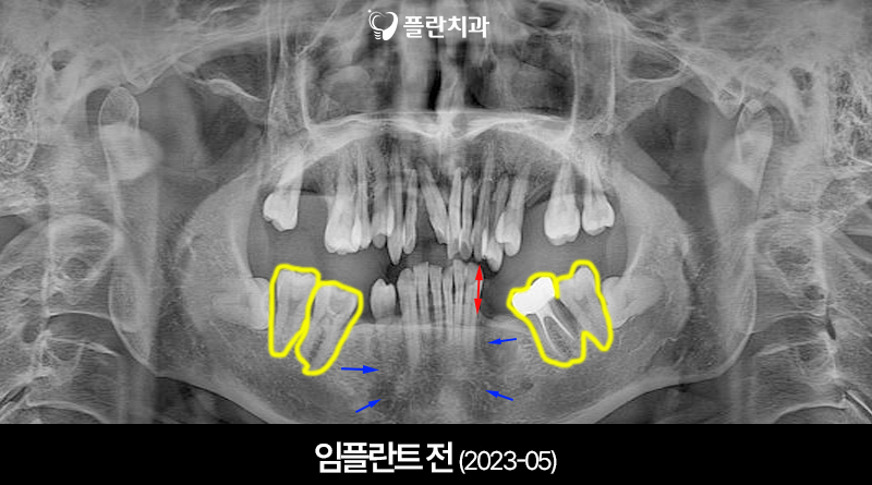 플란부평 이미지