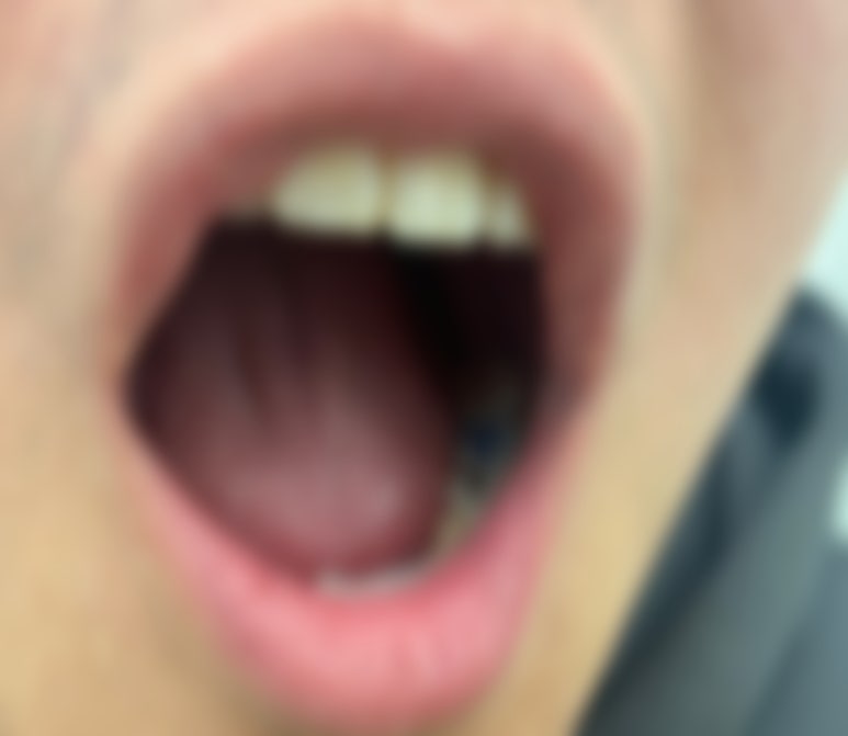 미소지음치과의원 이미지