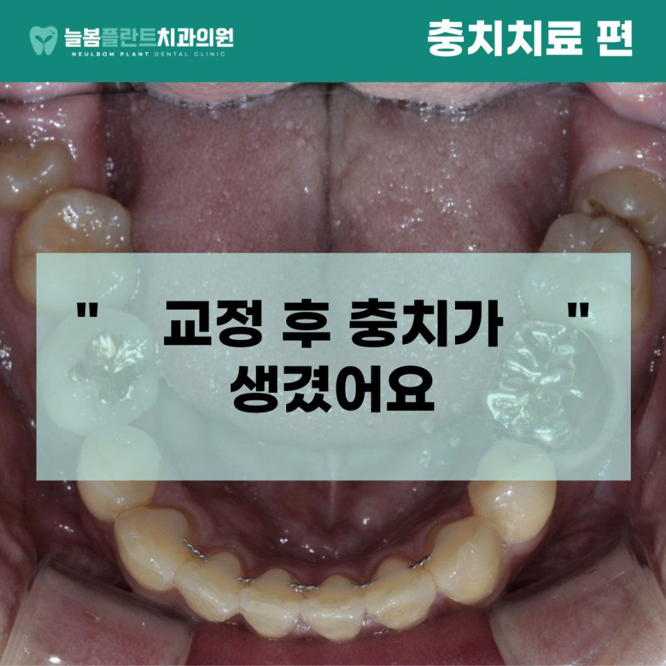 늘봄플란트치과 이미지