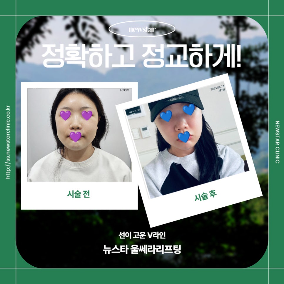 뉴스타의원 이미지