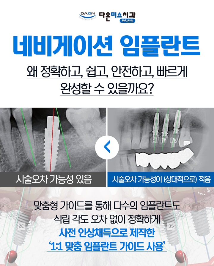 다온미소치과 이미지
