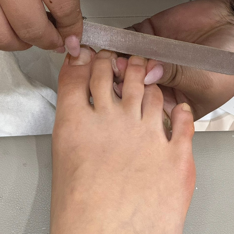 뚱네일 이미지