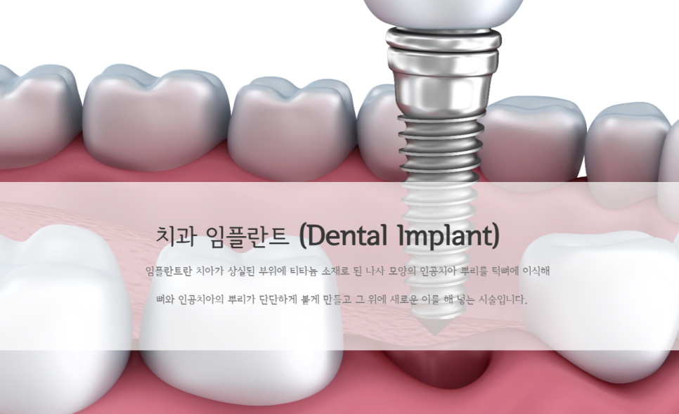 로덴치과 이미지