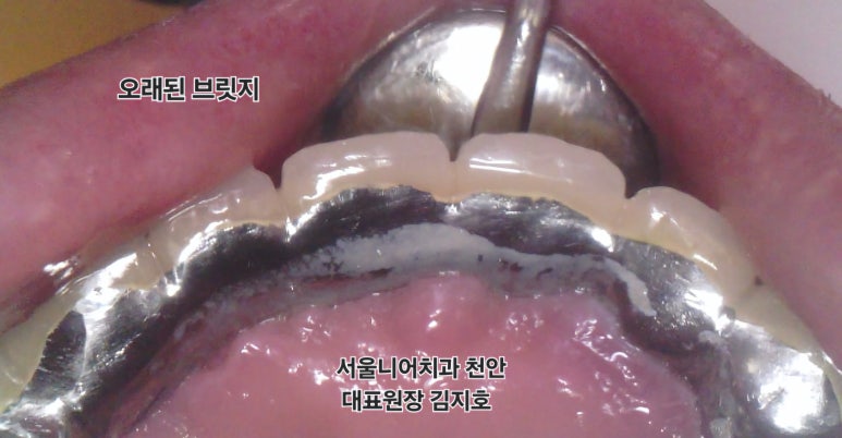 뉴욕리더스치과 이미지