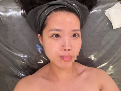 가림피부관리 이미지