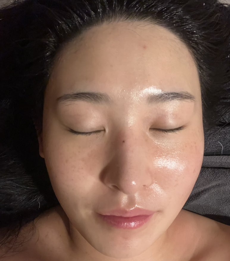 애띠스킨케어 이미지