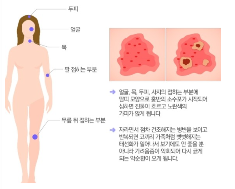 하늘토엠디의원;하늘토엠디한의원 이미지