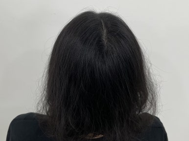 림스칼프 이미지