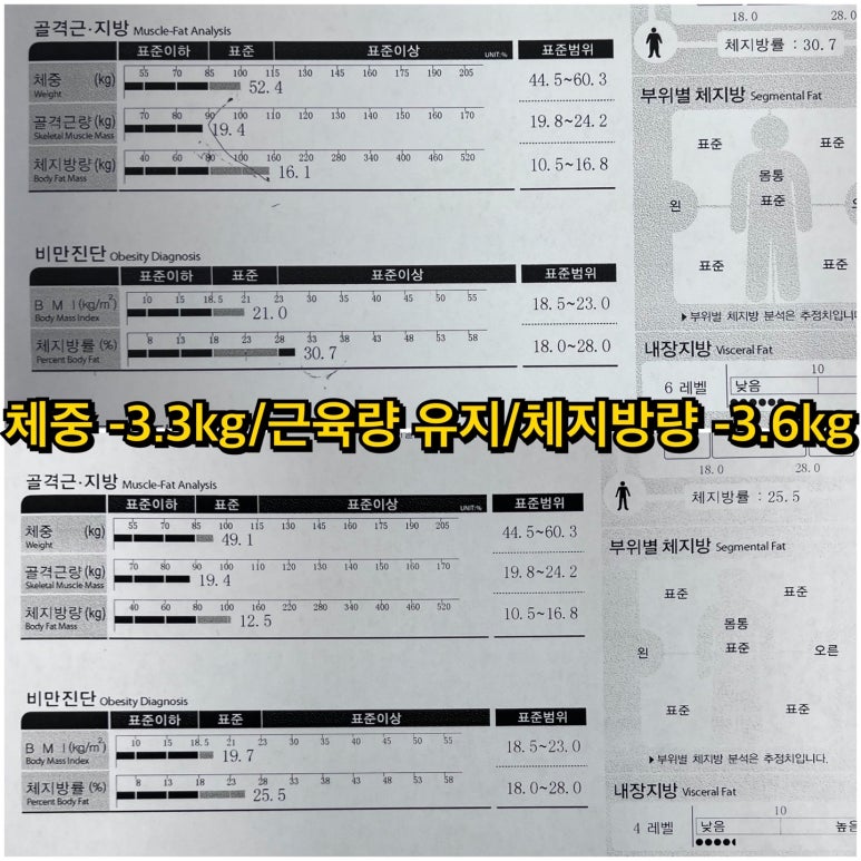리본짐 이미지