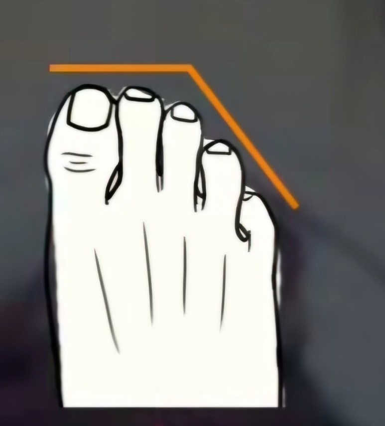 나의발 이미지