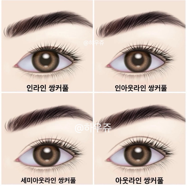 인아웃 이미지