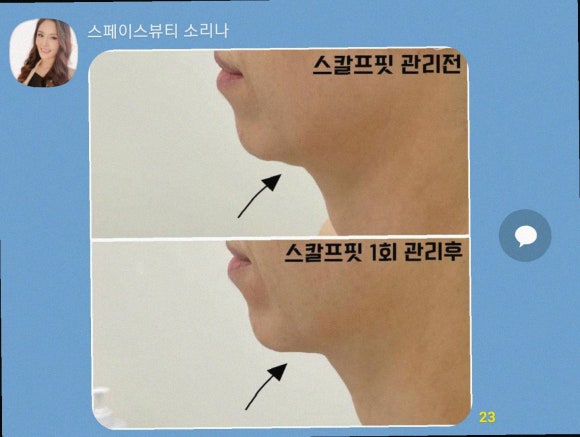 잘해관리 이미지