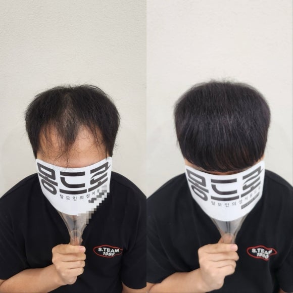 더몽드헤어 이미지